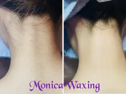 うなじ+もみあげWax脱毛