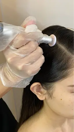 プロセルセラピーズ　頭皮