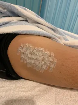 プロ選手も来院！特殊施術【学割】粒使用量(通常）