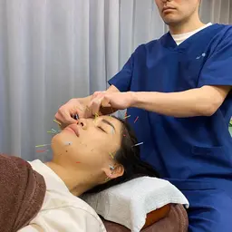 【初回】フェイシャル+美容鍼　4000円→3500円 （所要時間60～80分かかる場合があります。）