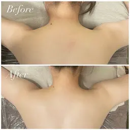 【18~29歳女性限定❣️】リンパドレナージュ⭐️