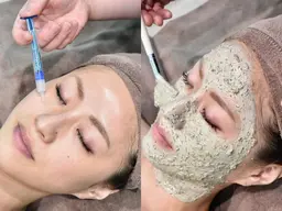 【肌質改革!美肌+背中ヘッド】 ハーブピーリングorインジェクション70分