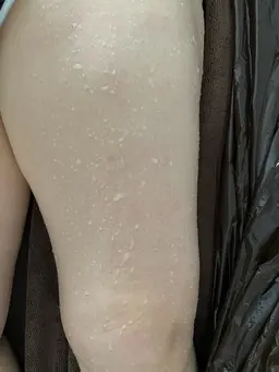 もみだし痩身　120分