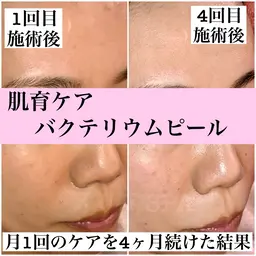 肌育フェイシャル★バクテリウムピール 60分
