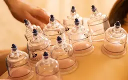 ✨ミニモ限定✨《6/30まで》大人気の《カッピング》定価6264円→4180円　全身の疲れをスッキリ💆🏻‍♀️