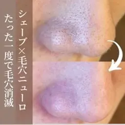 【強力毛穴洗浄】小鼻ケア毛穴ニューロ×シェービングエステ×ビタミン導入