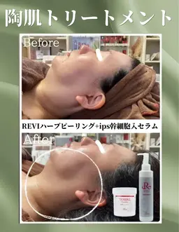 オープン記念♪REVI陶肌トリートメント2g（剥けないハーブピーリング）+IPSP幹細胞入セラム