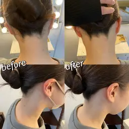 もみあげ、うなじ脱毛‼️これで、アップスタイルも完璧♡最新の光脱毛で、首元美人へ!美容ジェル仕様で綺麗に仕上げます!