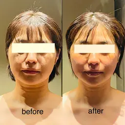 【整顔リセットマッサージ】当店人気小顔エステ✨【肩こり首凝りでお悩みの方も◎】シワ・たるみなどエイジングのお悩みにも♡