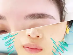 🟦眉毛Wax脱毛+リフトUP電気美容鍼🟦マッチングアプリでの出会いが変わる