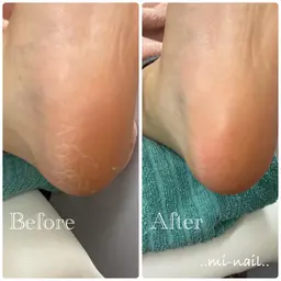 つるつるかかと🦶✨フット角質ケア