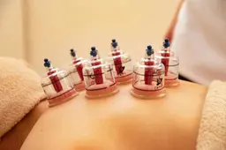 背面カッピング+大発汗ヒートマット浴¥13,500→¥8,800