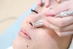 ピーリング✨毛穴吸引で汚れごっそり!クイックコース!貴方もタマゴ肌に◎