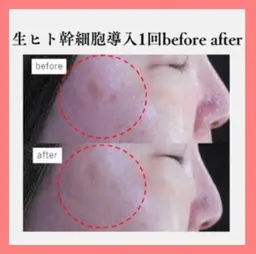 生ヒト幹細胞再生スペシャル