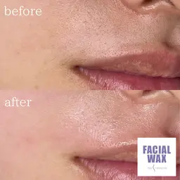 マリムーブフェイシャルワックス(高級パック付き)