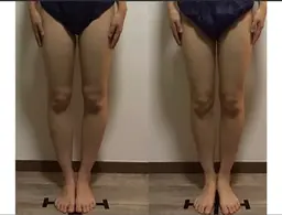 《下半身太りの方必見》ヒップUP•脚長効果•O脚改善も！