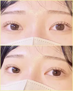 上マツパ+下マツパ