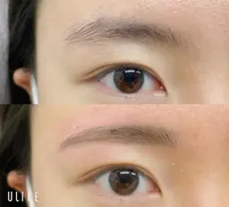 ハリウッドブロウリフト