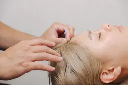 【まずは体験】初めての美容鍼に◎お悩み集中クイックコース30分✨15項目分析×自律神経美容鍼で変化を実感💆‍♀️