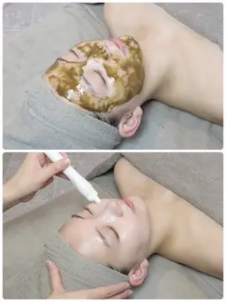 【毛穴＆くすみ改善🫧】肌質改善ハーブピーリング🌿×ハイドロフェイシャル✨艶肌ピーリング付❣️