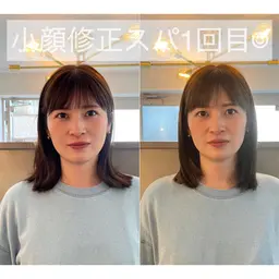 撮影モデル様募集♡前髪ｶｯﾄ付き小顔修正スパモデルさん