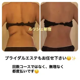 気になる部分集中✴︎🔥大量発汗🔥高周波&痩身揉み出し☆施術時間120分