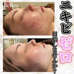 【どのメニューを選んだらいいかわからない方はこちら✋♥️】カウンセリング🎀お悩みに合わせご提案させていただきます😌