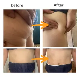 セルゼロ　ボディ+フェイス　モニター　３名限定