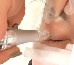 即感のシワケア ★目元、口元、ほうれい線だけでなく他ではできないまぶたや唇まで0.1ミリ単位のケア