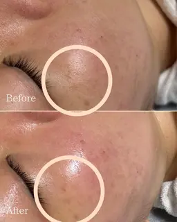 紫外線リセット美白マスク【ヘッドスパショートコース付き！】