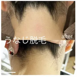 うなじ脱毛🦢シェービング付き🙆🏼‍♀️不自然にならない、元の生え方を活かしたデザインが得意です◎