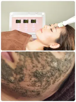 【最強ケア】プラズマシャワー×ハーブピーリング×ナチュラル整形®️(頭皮、ネック、デコルテ、背中)　お肌診断付き❗