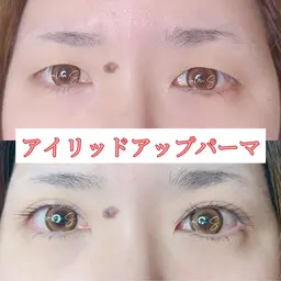 【仙台初】アイリッドアップパーマ（瞼引き上げマツパ）