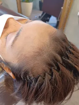 薄毛でお悩みの方に✨無料カウンセリング✨頭皮タトゥー(スカルプインク)