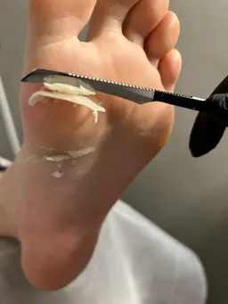 研修用モデル募集📷韓国式足裏フットケア🇰🇷👣ツルピカ足裏に変身✨⚠️日時指定，1名様のみ、足裏ガサガサさん限定