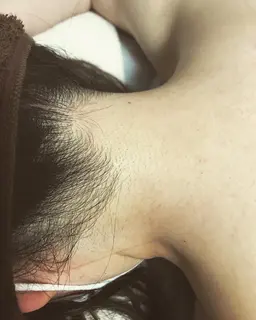 【女性限定】ここだけ1ヶ所脱毛