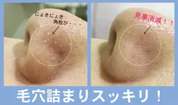 ⭐︎毛穴洗浄フェイシャル≪人気No1≫黒ずみ・ざらつき改善