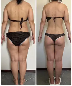 《ボディ痩身》ハイパーナイフ×セルライトを潰し流す！シェイプを組み合わせた痩身エステ🏹✨