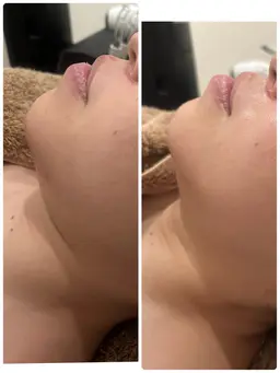 💆‍♀️お手軽人気コース☆デコルテ肩甲骨周り、リフトアップマッサージ付💆‍♀️『アドバンスコース+スペシャルケア』