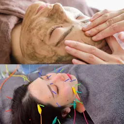 【陶器肌】🌿OHLハーブピーリング×美容鍼100分 剥離なし✨