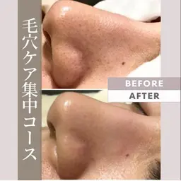 【毛穴汚れ・ザラつき改善】毛穴洗浄Face60分☆14300円→7700円