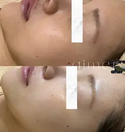 🌷3月限定🌷艶肌ピーリング＋水玉LDMリフティング＋筋膜リリース