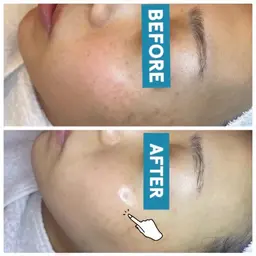 真っ白ツルツヤお肌へ🥚