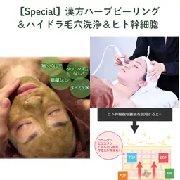 剥離無し🌿漢方ハーブピーリング+ハイドラ毛穴洗浄+ヒト幹細胞コース¥14000→【初回¥11000】