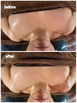 塩もみリンパマッサージ上半身(リンパ節解し・デコルテ・腕・背中)