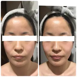 【和歌山で当店のみ💎】DDフェイシャル✨デトックス小顔＋ドレナージュ美肌💓毛穴ケア✨美白✨