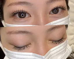 フラットラッシュ100本