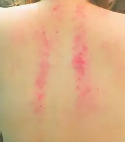 🩷女性限定🩷【時短でスッキリ】🌼オイルマッサージ+スライドカッピング🌼【上半身or下半身】