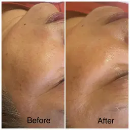 【ダイヤモンドピーリング⭐︎モニター様募集】