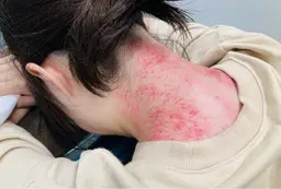 台湾式カッサ（首）